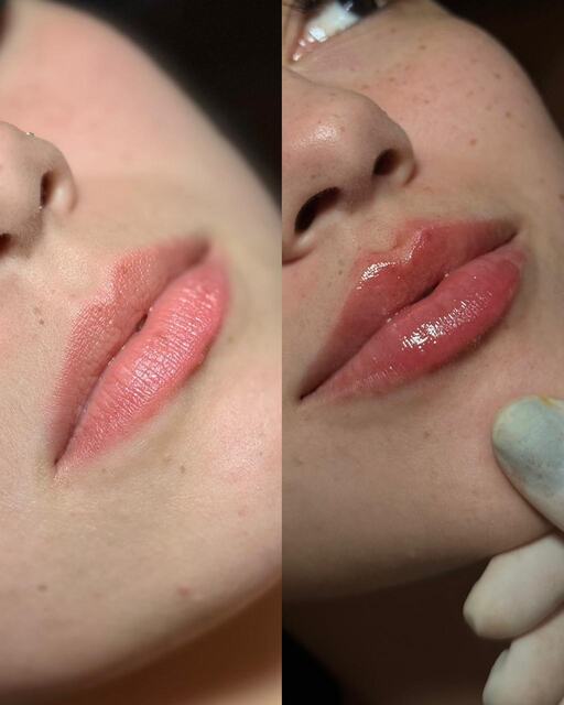 Caso clínico 09 de paciente da Armonya. Registro de antes e depois de tratamento odontológico.